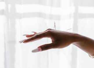 Xpert Clinics Hand- En Polszorg Amsterdam Larderhoogtweg: De Beste Zorg Voor Hand- En Polsklachten Xpert Clinics Hand- En Polszorg Amsterdam Larderhoogtweg: De Beste Zorg Voor Hand- En Polsklachten